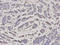 Proteasome Subunit Alpha 2 antibody, A08901, Boster Biological Technology, Immunohistochemistry paraffin image 