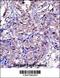 Matrix Metallopeptidase 11 antibody, 57-228, ProSci, Immunohistochemistry frozen image 
