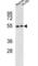 Nuclear Receptor Subfamily 1 Group H Member 2 antibody, abx033981, Abbexa, Western Blot image 