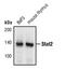 Signal Transducer And Activator Of Transcription 2 antibody, PA5-17439, Invitrogen Antibodies, Western Blot image 