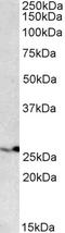 Nucleotide Binding Oligomerization Domain Containing 1 antibody, 42-460, ProSci, Western Blot image 