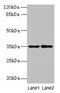 Serine Dehydratase Like antibody, CSB-PA020927LA01HU, Cusabio, Western Blot image 