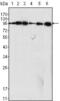 Dynamin 1 antibody, MA5-15285, Invitrogen Antibodies, Western Blot image 