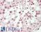 Androgen Receptor antibody, LS-B13271, Lifespan Biosciences, Immunohistochemistry paraffin image 