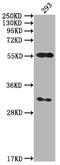 Calcium/Calmodulin Dependent Protein Kinase II Alpha antibody, CSB-PA892176HA11HU, Cusabio, Western Blot image 