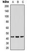 Pyruvate Dehydrogenase E1 Alpha 1 Subunit antibody, LS-B14565, Lifespan Biosciences, Western Blot image 