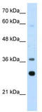 Ribosomal Protein Lateral Stalk Subunit P0 antibody, TA345695, Origene, Western Blot image 