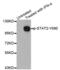 Signal Transducer And Activator Of Transcription 2 antibody, abx000335, Abbexa, Western Blot image 