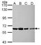 Nuclear RNA Export Factor 3 antibody, GTX116398, GeneTex, Western Blot image 