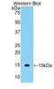 Thy-1 Cell Surface Antigen antibody, LS-C296631, Lifespan Biosciences, Western Blot image 