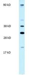 Poly(ADP-Ribose) Polymerase Family Member 11 antibody, GTX47755, GeneTex, Western Blot image 