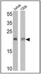 TCR V delta 2 antibody, TCR1732, Invitrogen Antibodies, Western Blot image 