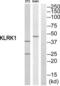 Killer Cell Lectin Like Receptor K1 antibody, LS-C824950, Lifespan Biosciences, Western Blot image 