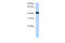 General Transcription Factor IIA Subunit 1 Like antibody, 30-665, ProSci, Enzyme Linked Immunosorbent Assay image 