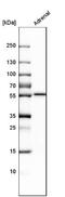 Cytochrome P450 Family 21 Subfamily A Member 2 antibody, NBP2-13893, Novus Biologicals, Western Blot image 