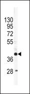 Apolipoprotein L1 antibody, LS-C100542, Lifespan Biosciences, Western Blot image 