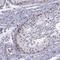 Chromosome 3 Open Reading Frame 22 antibody, NBP2-31754, Novus Biologicals, Immunohistochemistry paraffin image 