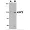 Kinesin Family Member 5A antibody, TA306456, Origene, Western Blot image 