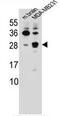 Cerebellin 2 Precursor antibody, AP50743PU-N, Origene, Western Blot image 