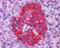 Annexin A10 antibody, orb18838, Biorbyt, Immunohistochemistry paraffin image 