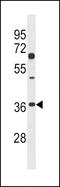 Dickkopf WNT Signaling Pathway Inhibitor 2 antibody, 58-168, ProSci, Western Blot image 