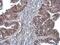 DNA polymerase delta catalytic subunit antibody, GTX77606, GeneTex, Immunohistochemistry paraffin image 