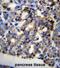 Twinkle protein, mitochondrial antibody, abx027021, Abbexa, Immunohistochemistry paraffin image 