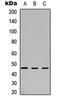 Arylsulfatase B antibody, orb235024, Biorbyt, Western Blot image 