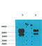 Gamma-Aminobutyric Acid Type A Receptor Gamma2 Subunit antibody, A02361, Boster Biological Technology, Western Blot image 