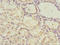 Pyruvate Dehydrogenase E1 Beta Subunit antibody, orb40141, Biorbyt, Immunohistochemistry paraffin image 