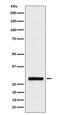 BRMS1 Transcriptional Repressor And Anoikis Regulator antibody, M03587, Boster Biological Technology, Western Blot image 