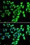 N-Myristoyltransferase 2 antibody, orb247761, Biorbyt, Immunofluorescence image 