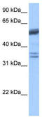Coilin antibody, TA335742, Origene, Western Blot image 