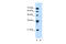 Solute Carrier Family 17 Member 3 antibody, 29-731, ProSci, Western Blot image 