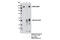 ATP Binding Cassette Subfamily B Member 1 antibody, 12683S, Cell Signaling Technology, Immunoprecipitation image 