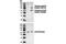 Ribosomal Protein S6 Kinase B1 antibody, 9206S, Cell Signaling Technology, Western Blot image 