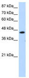 General Transcription Factor IIH Subunit 4 antibody, TA335199, Origene, Western Blot image 