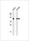 MPP1 antibody, 61-548, ProSci, Western Blot image 