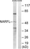 Cytosolic Iron-Sulfur Assembly Component 3 antibody, LS-C120171, Lifespan Biosciences, Western Blot image 