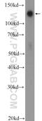 Transforming acidic coiled-coil-containing protein 3 antibody, 25697-1-AP, Proteintech Group, Western Blot image 