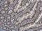 Pygopus Family PHD Finger 2 antibody, NBP2-20019, Novus Biologicals, Immunohistochemistry paraffin image 