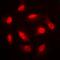 Protein Kinase AMP-Activated Non-Catalytic Subunit Beta 1 antibody, orb216181, Biorbyt, Immunofluorescence image 