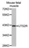 Urotensin 2 Receptor antibody, PA5-76683, Invitrogen Antibodies, Western Blot image 