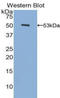 Fibrinogen Beta Chain antibody, LS-C298386, Lifespan Biosciences, Western Blot image 