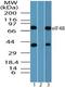 Eukaryotic Translation Initiation Factor 4B antibody, PA5-23261, Invitrogen Antibodies, Western Blot image 