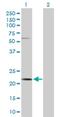 Casein Kappa antibody, H00001448-D01P, Novus Biologicals, Western Blot image 