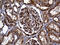 Carboxypeptidase M antibody, M01650, Boster Biological Technology, Immunohistochemistry paraffin image 