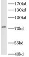 Long-chain-fatty-acid--CoA ligase 3 antibody, FNab00107, FineTest, Western Blot image 