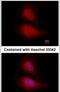 Forkhead Box O1 antibody, MA1-23230, Invitrogen Antibodies, Immunofluorescence image 