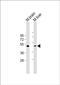 Tubulin Gamma 2 antibody, PA5-72355, Invitrogen Antibodies, Western Blot image 